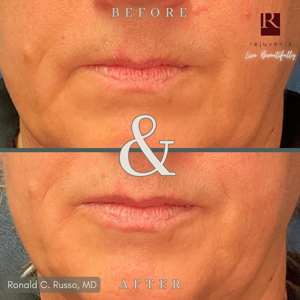 Images Rejuvenis Facial Cosmetic Surgery and Medical Spa