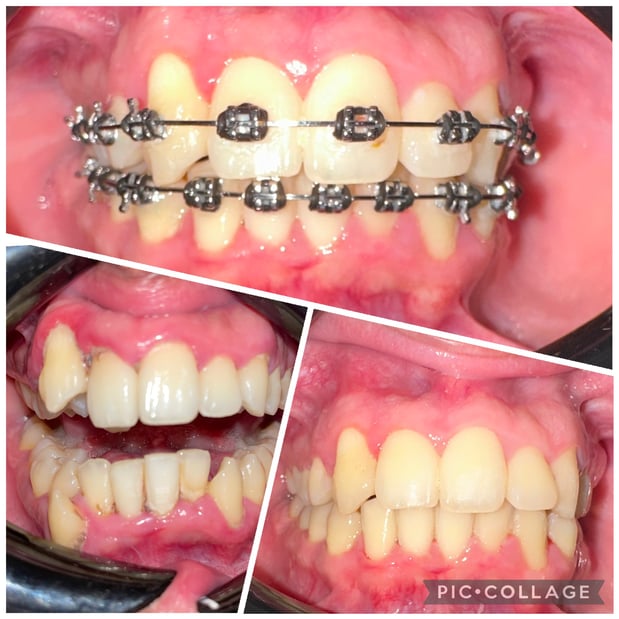 Images Cortes Family Dentistry