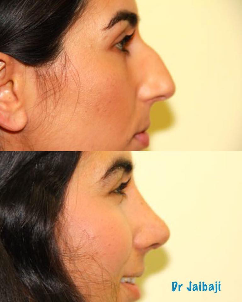 Jaibaji Plastic Surgery Photo