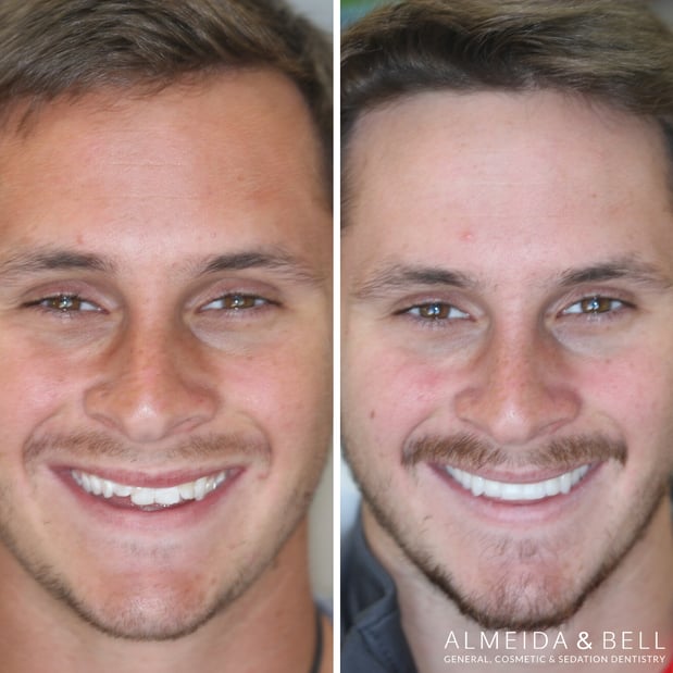 Images Almeida & Bell Dental Lone Tree - General, Cosmetic, and Implant Dentistry