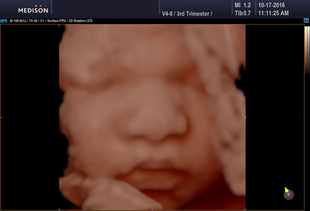 Images Heavenly 3D 4D Ultrasounds