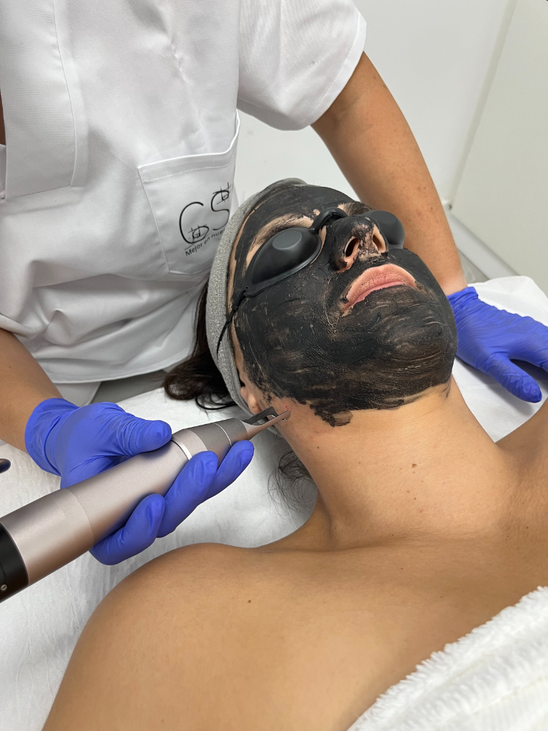 Images Dra. Silvia Solà. Medicina Estética y Láser