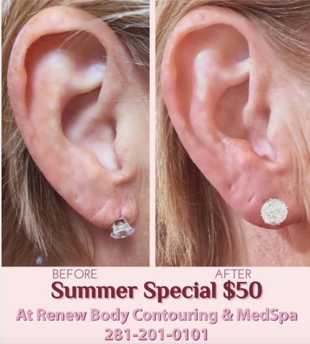 Images Renew Body Contouring & MedSpa