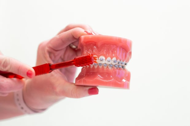 Images Davillier Orthodontics