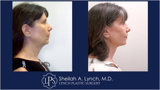 Images Dr. Sheilah A. Lynch