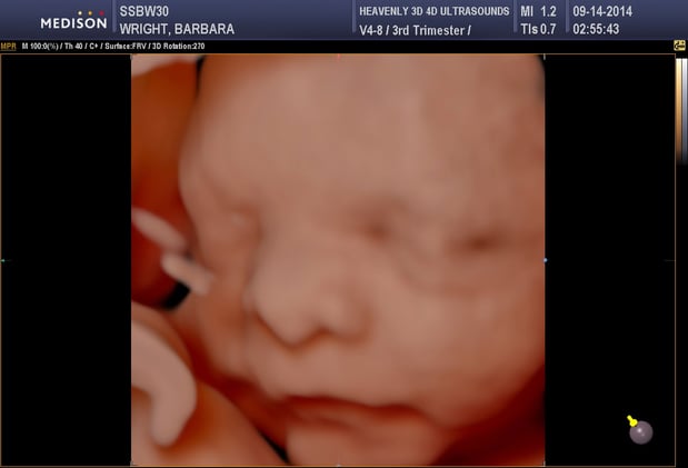 Images Heavenly 3D 4D Ultrasounds-Upland