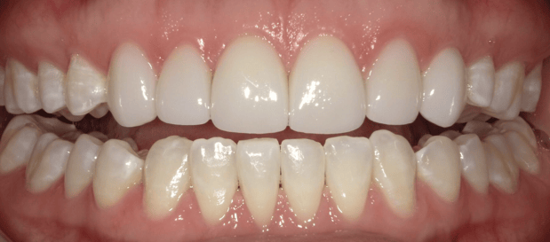 Images Dunwoody Dental