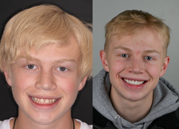 Images Hoopes Dental