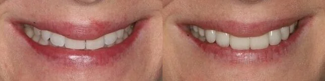 Images Iroquois Dentistry