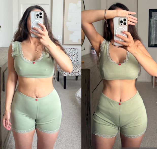 Images Chua Plastic Surgery