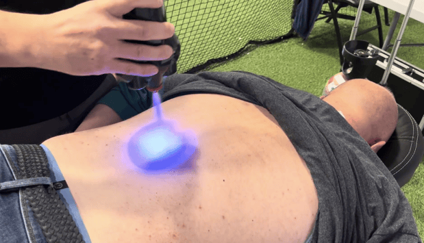 Images CRYOLumina Body Sculpting
