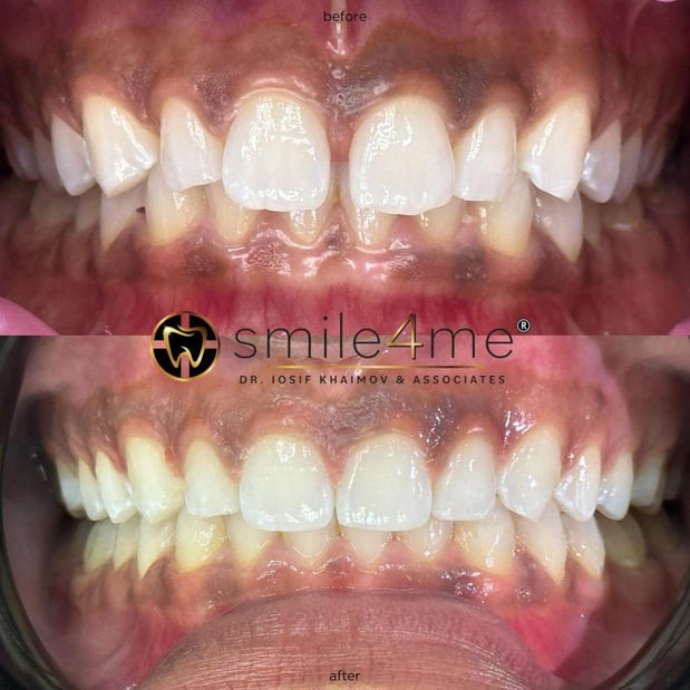 Images smile4me Dental Care - Astoria, Queens