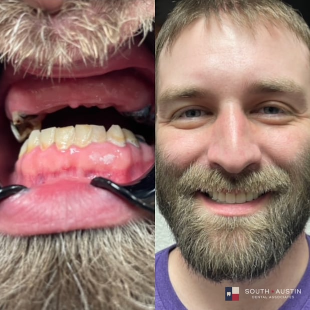 Images South Austin Dental Associates