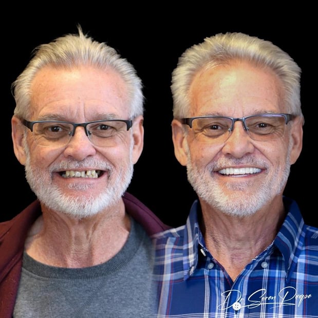 Images Smile Now Denver Dentures and Implants