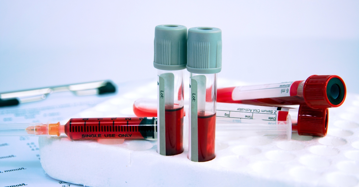 Comprehensive Blood Analysis