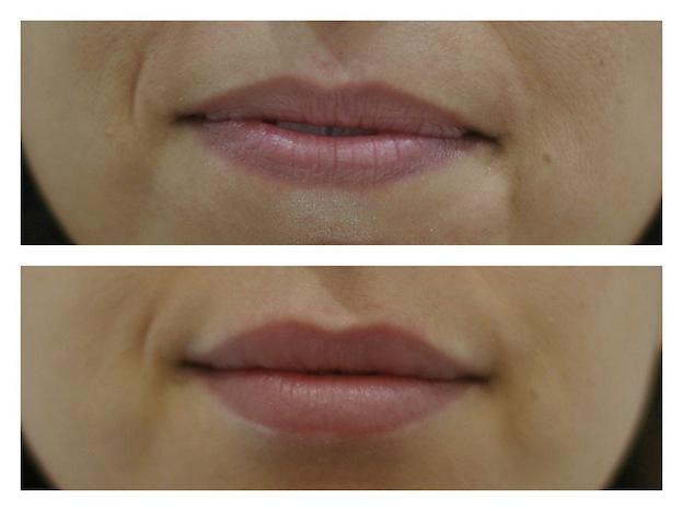 Images About Face Medical Aesthetics - Richmond