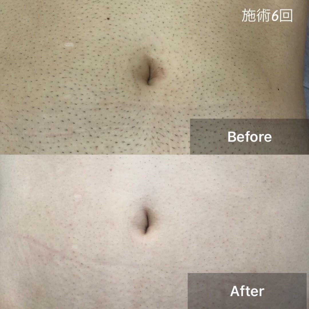 Images Private Salon BB