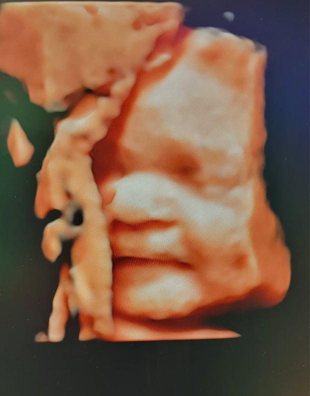 Images Love At First Sight 3D/4D Ultrasound Imaging Studio, LLC