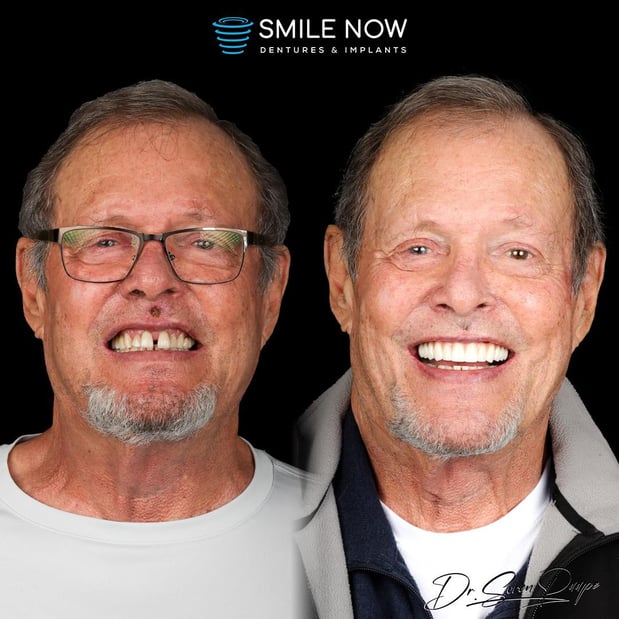 Images Smile Now Denver Dentures and Implants