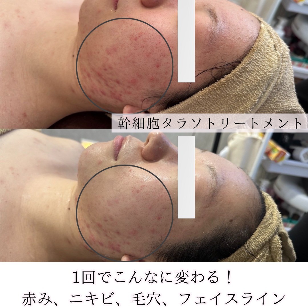 Images アディス リティフル