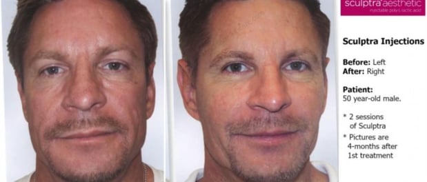 Images Renew Body Contouring & MedSpa