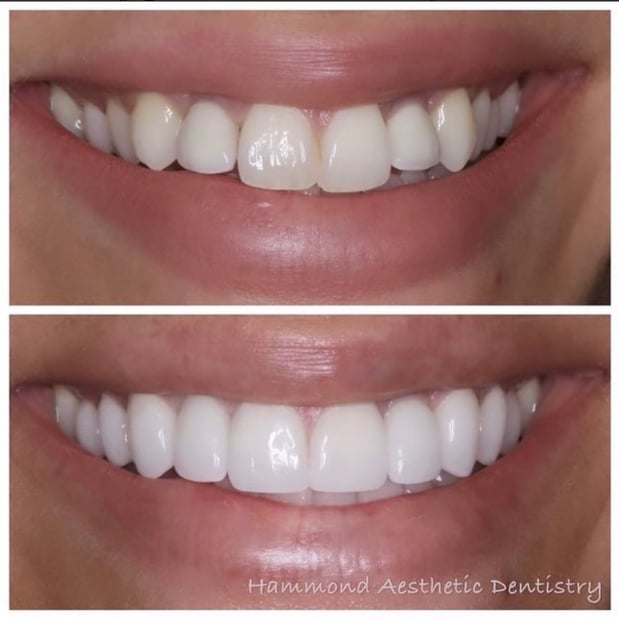 Images Hammond Aesthetic & General Dentistry