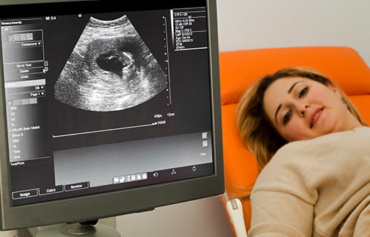 Images Baby See Baby Due 4D Imaging Studio