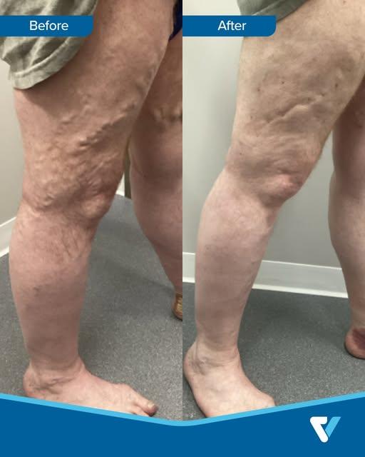 Images Physicians Vein Clinics