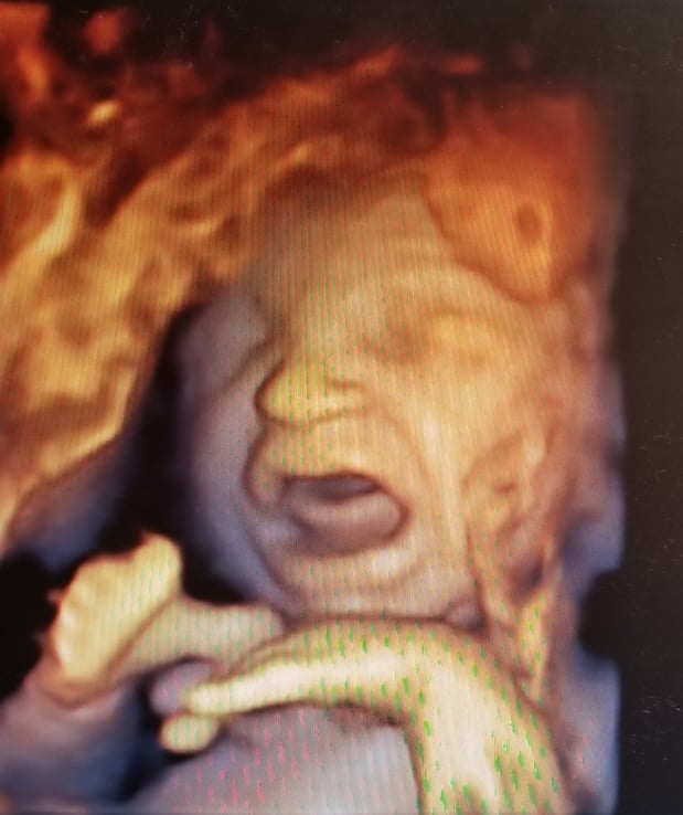 Images Love At First Sight 3D/4D Ultrasound Imaging Studio, LLC