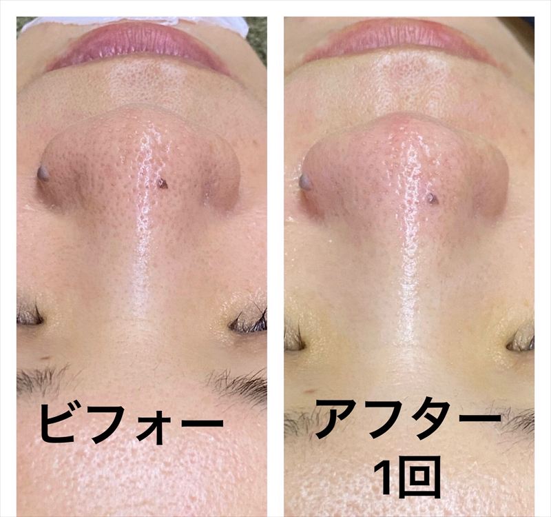 Images 肌質改善サロンサルヴァトーレ長崎