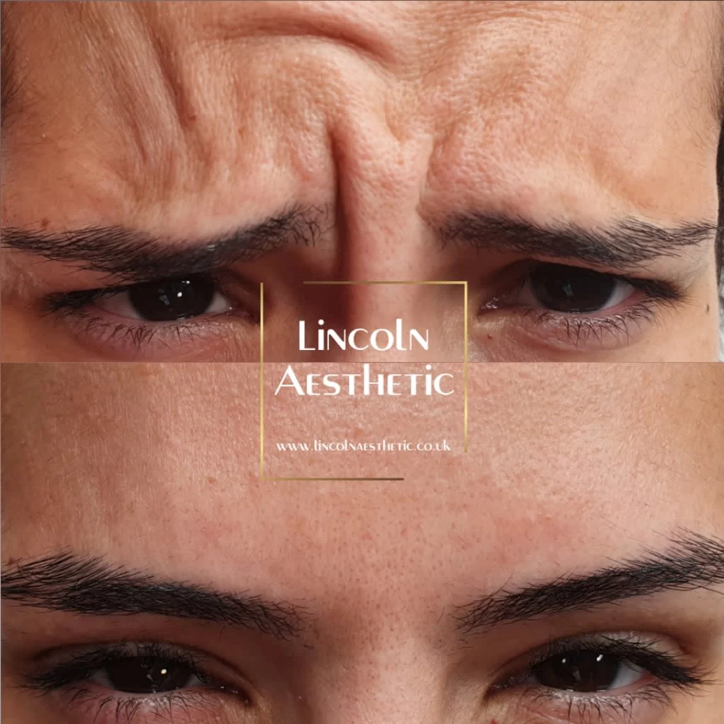 Images Lincoln Aesthetic