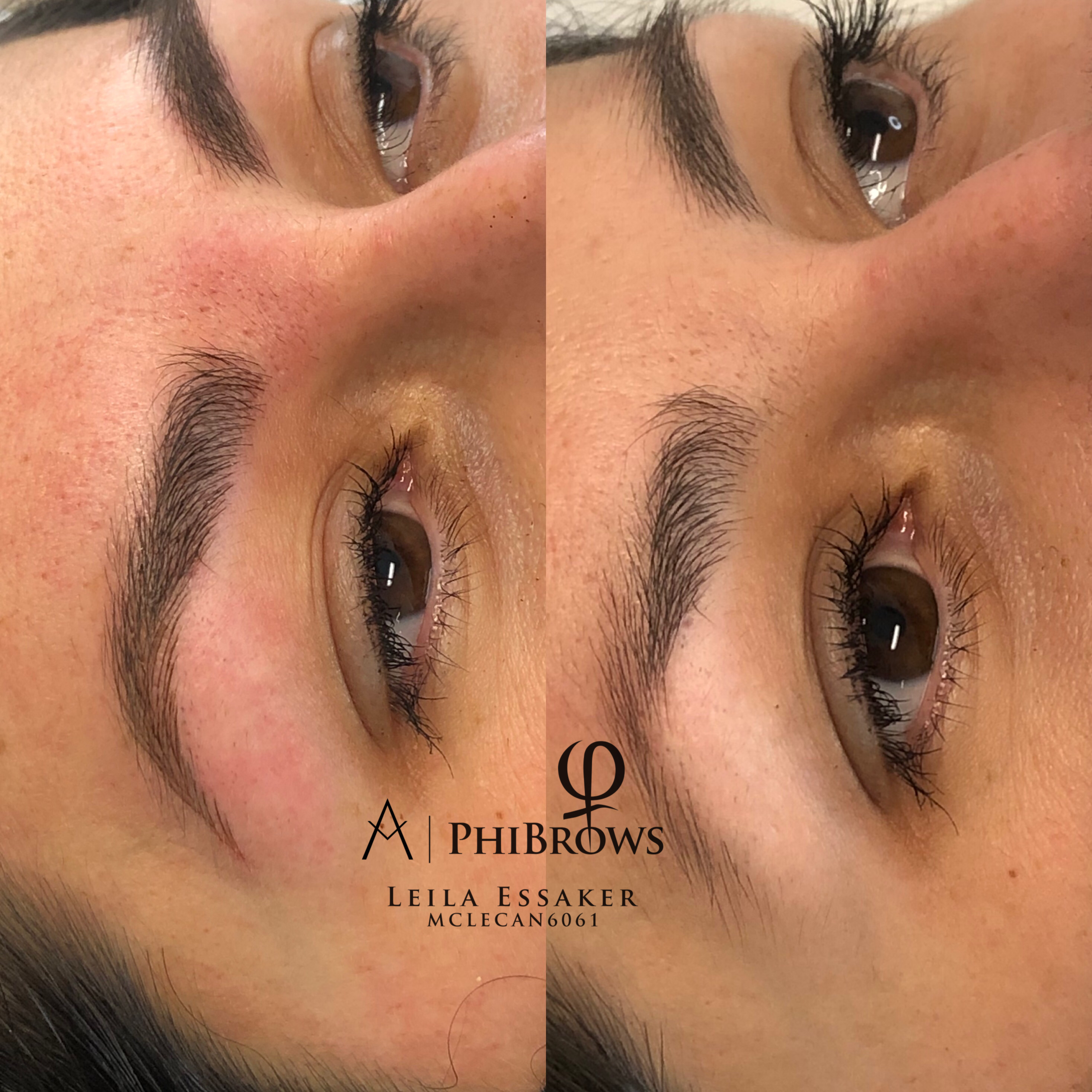 Images Clinique d'Esthétique Leila - Hydrafacial, Microblading, Épilation Laser Sainte-Foy