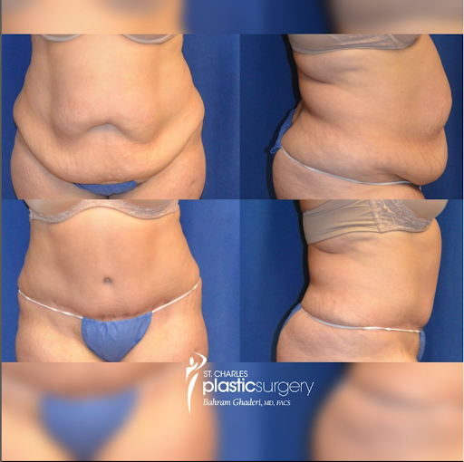 Images St. Charles Plastic Surgery