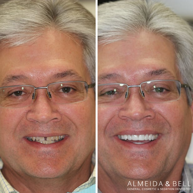 Images Almeida & Bell Dental Lone Tree - General, Cosmetic, and Implant Dentistry