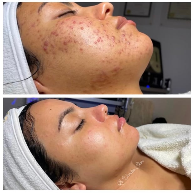 Images Le Vardia Skin