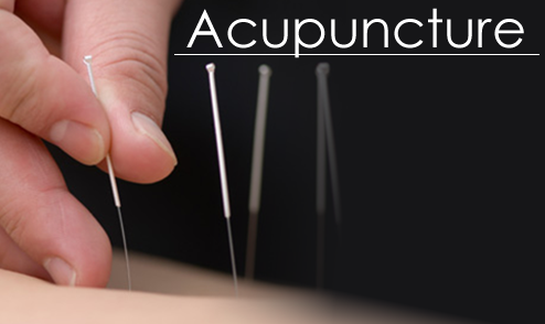 Images Acupuncture For Life