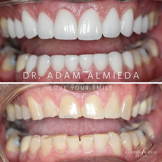 Images Almeida & Bell Dental Lone Tree - General, Cosmetic, and Implant Dentistry