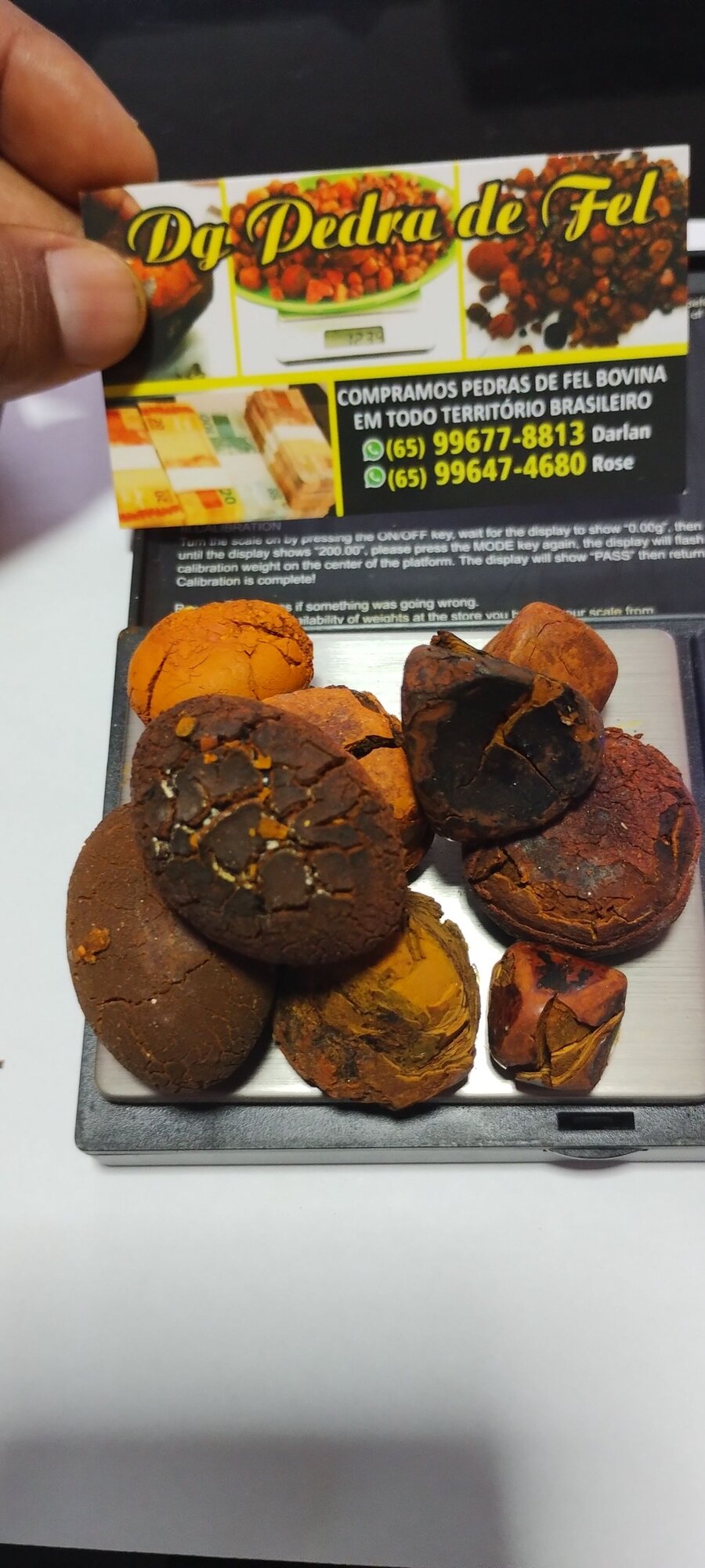 Images Dg pedras de fel bovinos