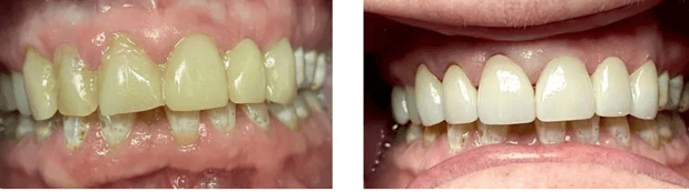 Images Allen Dentistry