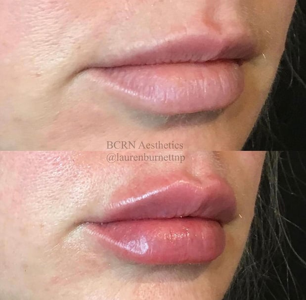 Images BCRN Aesthetics MedSpa