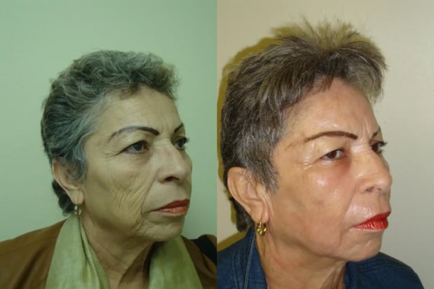 Images Providence Facial Plastic and Cosmetic Surgery