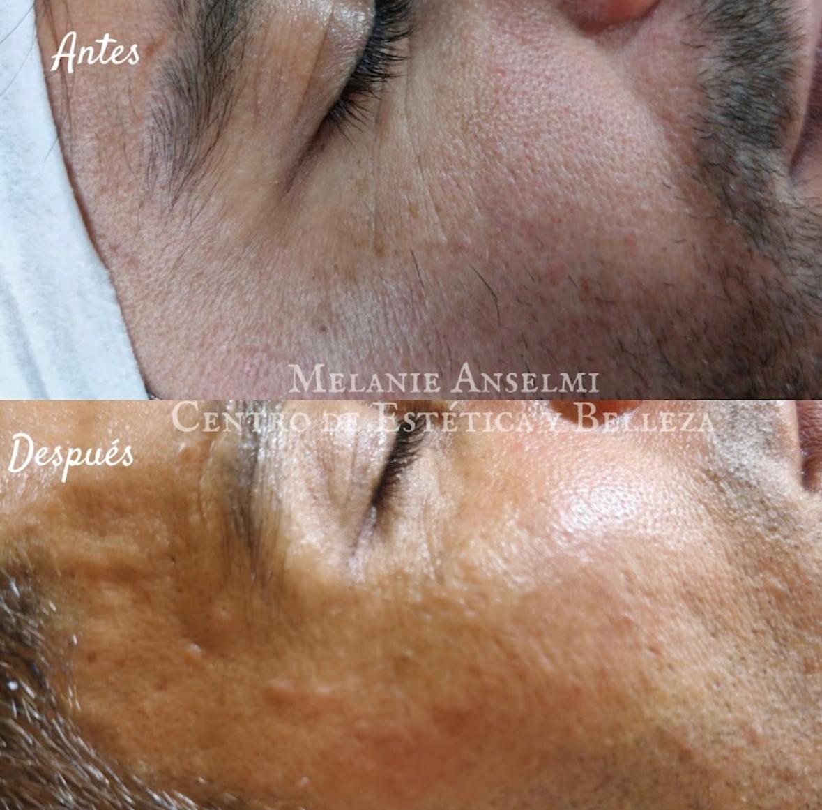 Images Melanie Anselmi Centro de Estética y Belleza