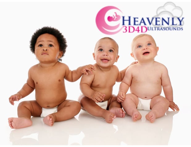 Images Heavenly 3D 4D Ultrasounds