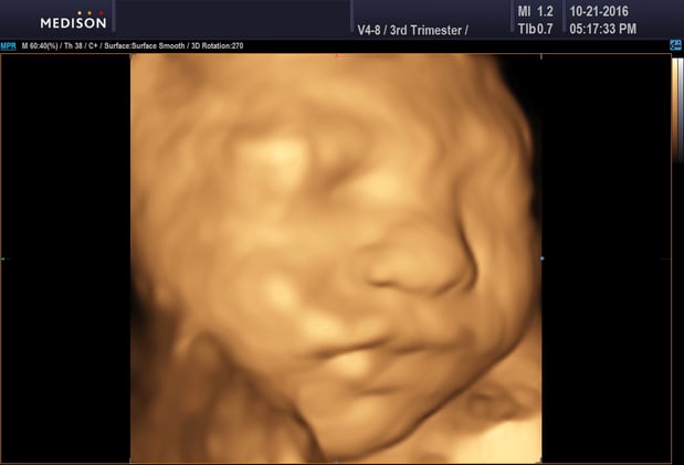 Images Heavenly 3D 4D Ultrasounds