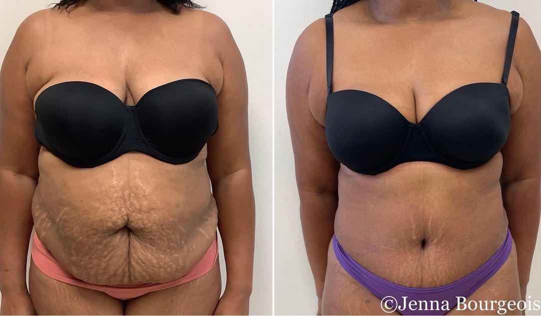 Dr. Jenna M. Bourgeois MD Image