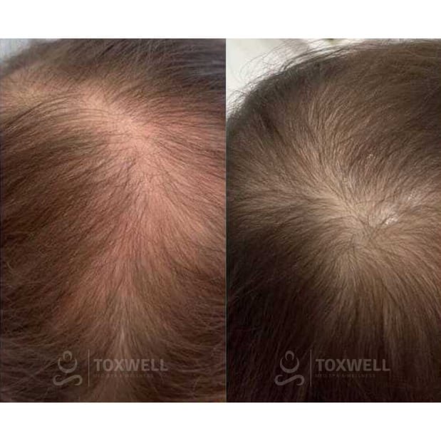 Images Toxwell Med Spa and Wellness