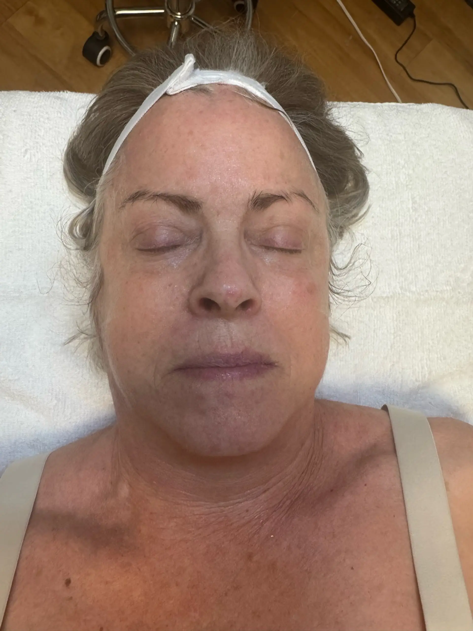 A close-up overhead shot of a woman's face as she lies with her eyes closed, wearing a white headband. She is on a white towel, and in the background, a wooden floor and medical equipment are visible. Her skin appears somewhat flushed, and there are visible pores and fine lines. The lighting is soft and appears to be from above.