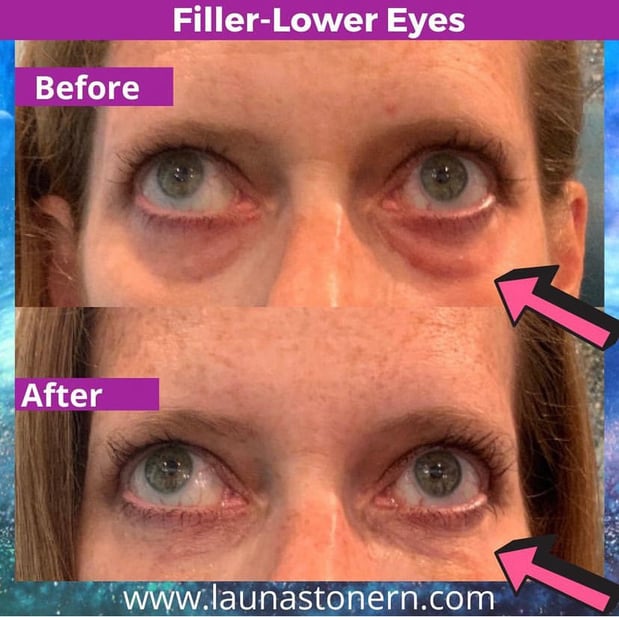 Images Launa Stone, R.N.