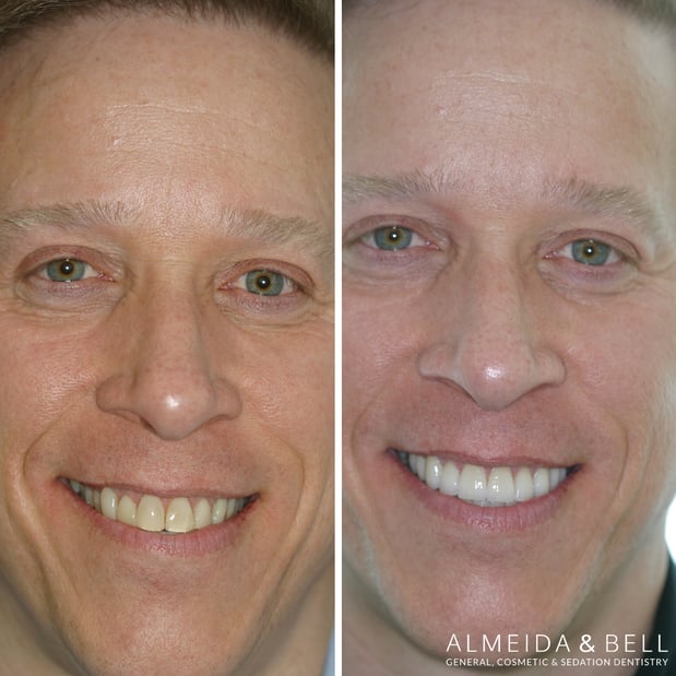 Images Almeida & Bell Dental Lone Tree - General, Cosmetic, and Implant Dentistry