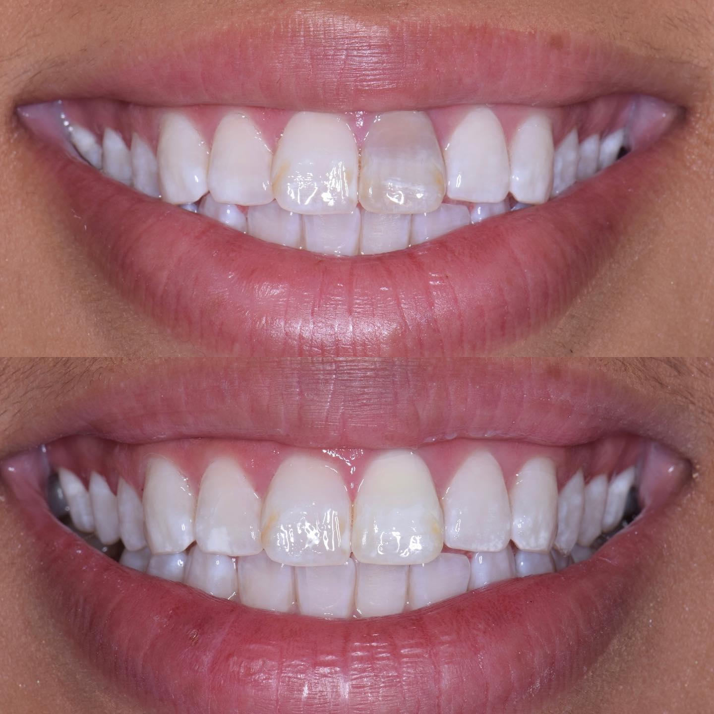 Before & After from Parkway Dental: Michael D Haight, DDS | Albuquerque, NM